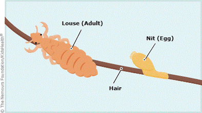 The FAQs of Lice